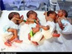 نوزادان ۵ قلو در قم متولد شدند