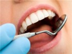 رعایت نکردن بهداشت مهمترین عامل مشکلات دهان و دندان