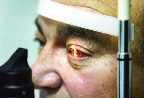 آخرین وضعیت صدمه‌دیدگان کلینیک چشم‌ پزشکی قم؛ ۲ نفر نابینا شدند