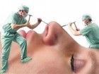 روش ایرانی جراحی زیبایی که نارضایتی بیمار را کاهش می‌دهد